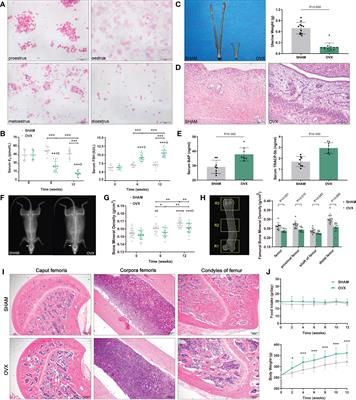 An integrated study of hormone-related sarcopenia for modeling and comparative transcriptome in rats